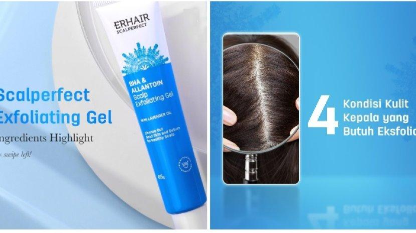 Review ERHAIR Scalperfect Exfoliating Gel, Solusi Ampuh Mengatasi Gatal dan Ketombe