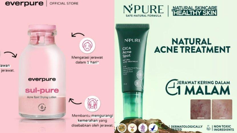 Battle Produk Acne Spot everpure vs NPURE, Apakah Sama-sama Ampuh Hempas Jerawat?