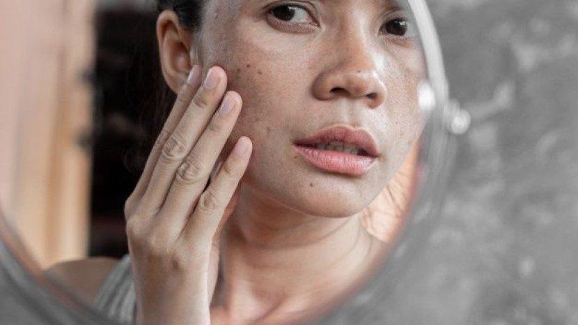 Bahan Rumahan yang Ampuh Samarkan Bintik Hitam pada Wajah, Bisa Gunakan Pepaya hingga Tomat