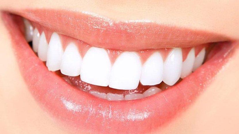 8 Cara Alami Memutihkan Gigi tanpa Biaya Mahal dan Bisa Dilakukan Sendiri di Rumah