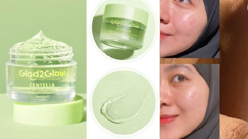 Review Glad2Glow Centella Allantoin Soothing Gel Moisturizer, Pelembap Baru untuk Kulit Berjerawat