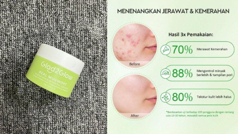 Review Glad2Glow Real Mugwort Salicylic Acid Acne Control Clay Mask, Ampuh Meredakan Iritasi Kulit