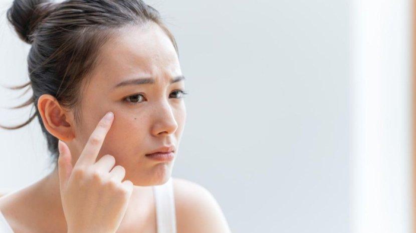 7 Kandungan Skincare Ini Sebaiknya Kamu Gunakan untuk Memperbaiki Skin Barrier 