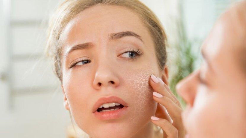 Tak Cukup Pelembap, Ini Cara Atasi Kulit Kering di Musim Kemarau dengan 4 Bahan Ini