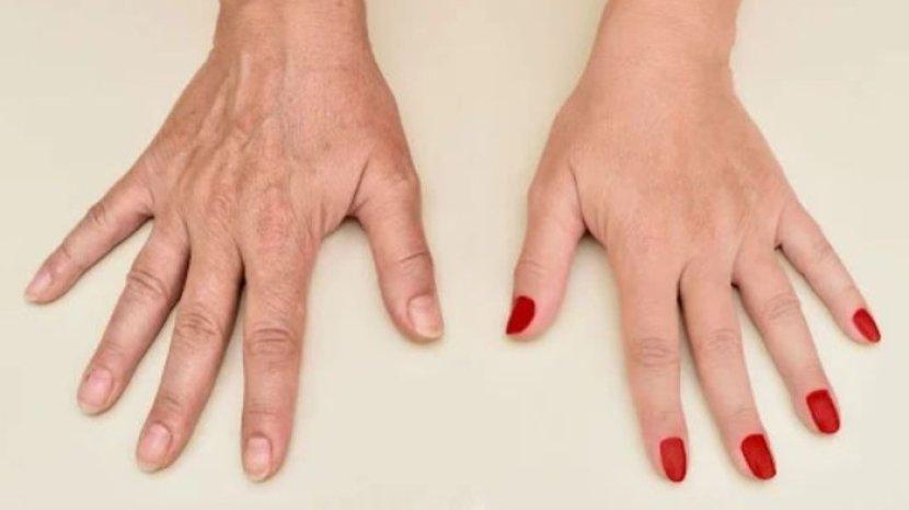 Kurangi Keriput di Tangan dengan 7 Bahan Alami Berikut Ini, Bikin Jari Makin Lentik
