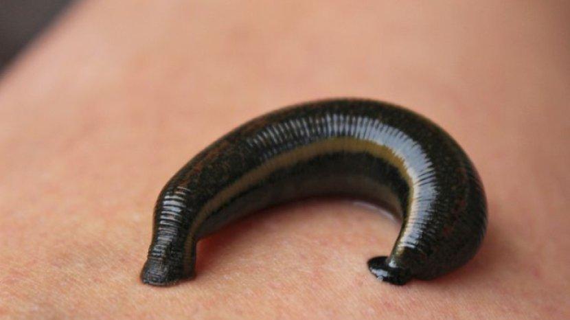 5 Tips Mengusir Lintah di Kamar Mandi, Ampuh dengan Bahan Alami