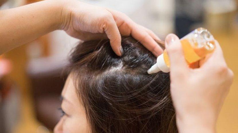 7 Manfaat Rutin Pakai Hair Tonic, Bisa Bikin Rambut Sehat dan Tampak Berkilau