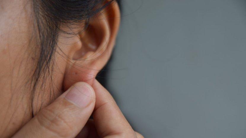 6 Penyebab Jerawat Bisa Muncul di Telinga, Salah Satunya Sering Pakai Headset