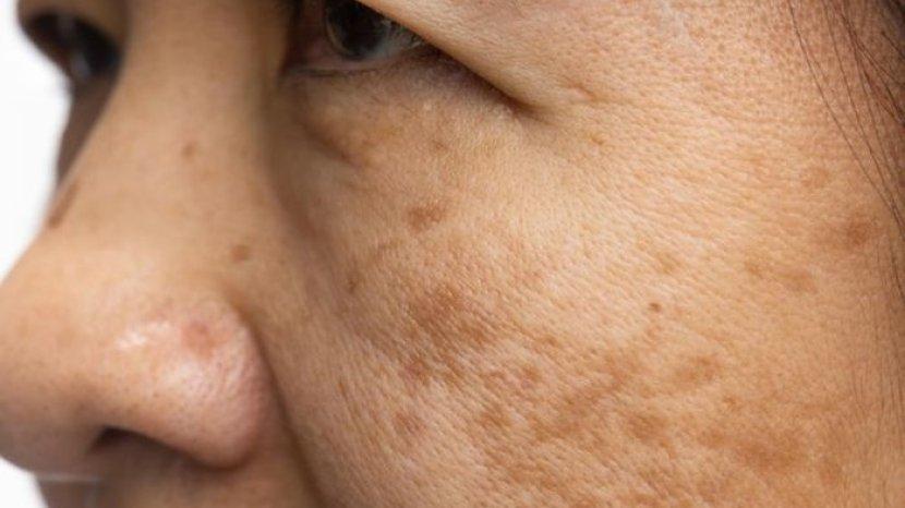 8 Pilihan Masker Wajah dari Bahan Alami Ini Ampuh Hempas Flek Hitam di Usia 40an