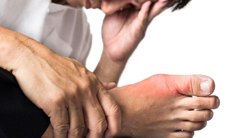 7 Jamu Herbal Ini Ampuh Mengatasi Asam Urat, Bahan-bahan Mudah Dijamin Bisa Diramu Sendiri di Rumah