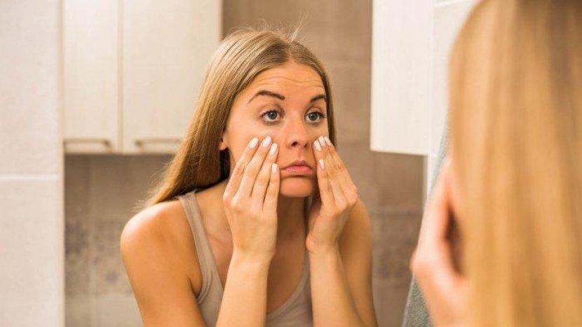 Kantung Mata Semakin Terlihat Menghitam? 4 Hal Sepele Ini Bisa Jadi Penyebabnya