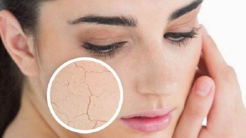 5 Skincare Emina yang Cocok untuk Kulit Kering