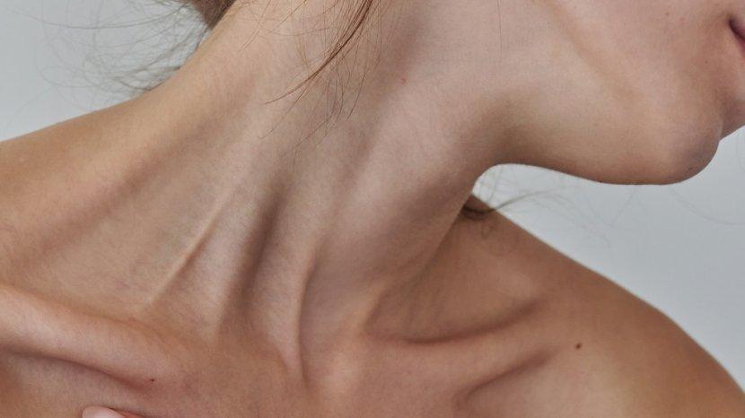 Bukan Hanya Daki, Ini Penyebab Kulit Ketiak dan Leher Menghitam