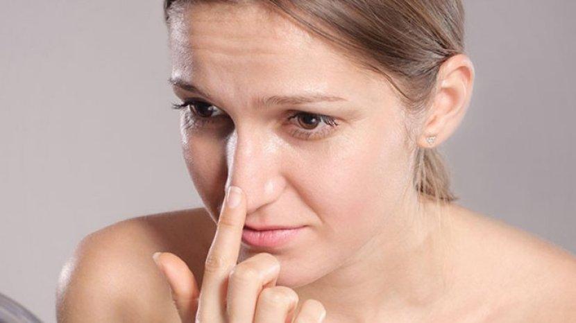 Tips Menghilangkan Komedo Hitam Pada Wajah dengan Bahan Alami