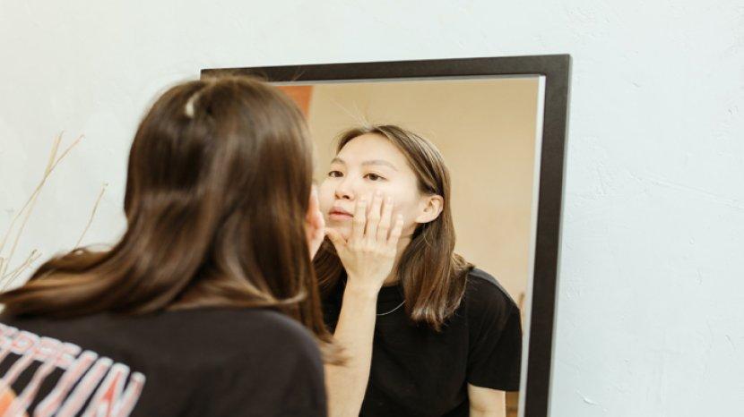 5 Pilihan Milk Cleanser yang Cocok untuk Kulit Berjerawat