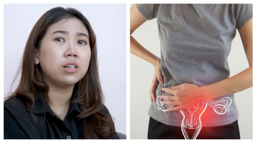 kabar-kiky-saputri-kista-ovarium.jpg