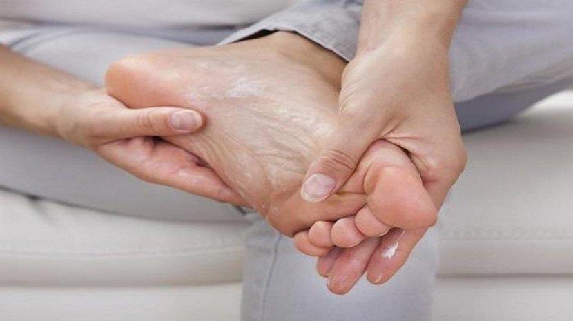 4 Bahan Alami Ini Dipercaya Bisa Atasi Kapalan pada Kaki
