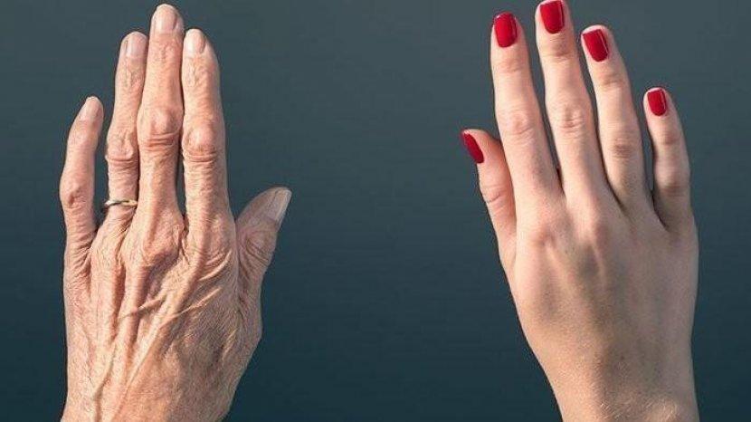 Hanya dengan Cara Ini Kerutan di Tangan Hilang Tak Butuh Waktu Lama dan Perawatan Mahal