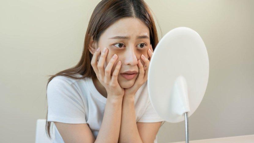 Ketahui Penyebab Mata Bengkak dan Sembuhkan dengan 6 Cara Ini