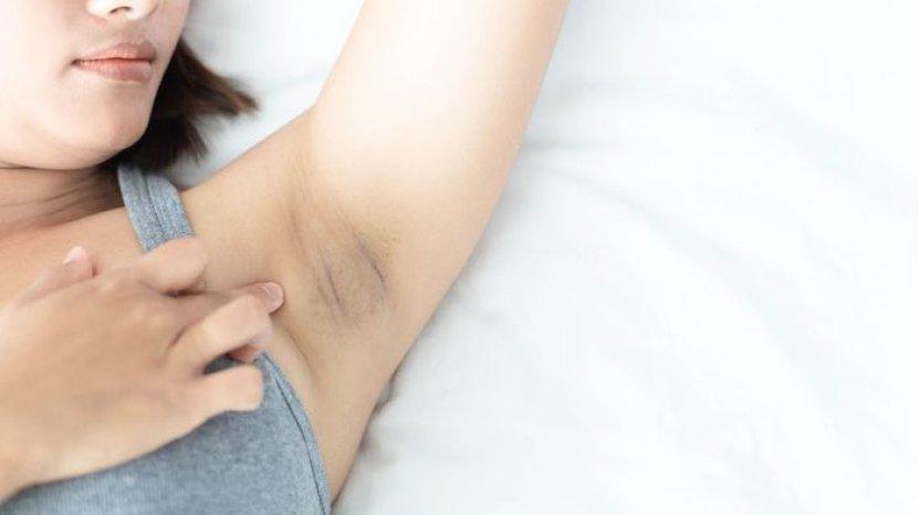 10 Bahan Murah-meriah Ampuh Mencerahkan Ketiak Hitam, Tak Perlu Biaya Mahal ke Klinik Kecantikan