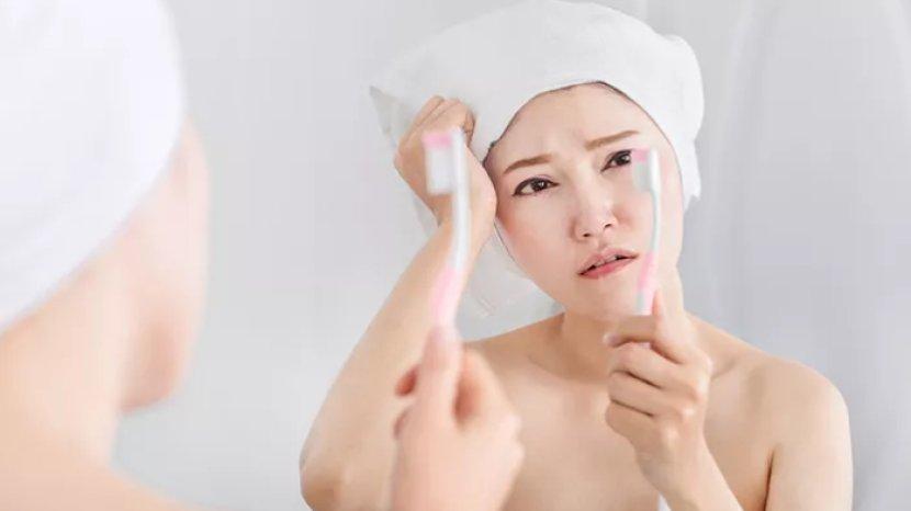 Cara Menghilangkan Komedo Menggunakan Pasta Gigi dan Bahan Alami Lainnya, Gampang Dipraktikan