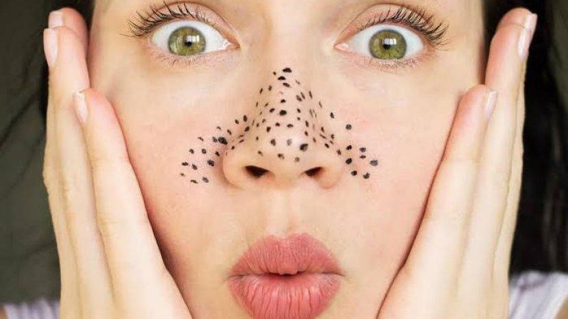 5 Rekomendasi Produk Atasi Komedo dengan Cepat Terbaik di Sociolla