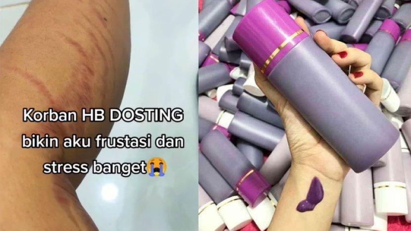 Mengenal Apa Itu HB Dosting dan 7 Bahayanya untuk Kulit yang Lagi Ramai di TIKTOK