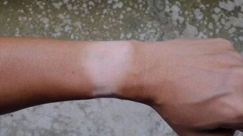 Kulit Belang Kembali Cerah dengan Perawatan Rutin Menggunakan 9 Bahan Alami Ini