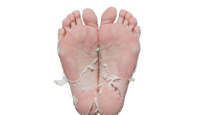 3 Resep Alami untuk Membuat Telapak Kaki Mulus dan Bebas Pecah-pecah