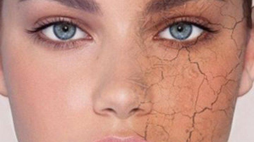 Coba Perhatikan Ini Untuk Memilih Moisturizer yang Cocok Bagi Kulit Kering