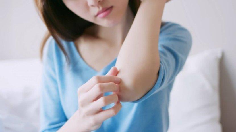 Kulit Siku Kering dan Kasar, Atasi dengan 5 Cara Berikut Ini