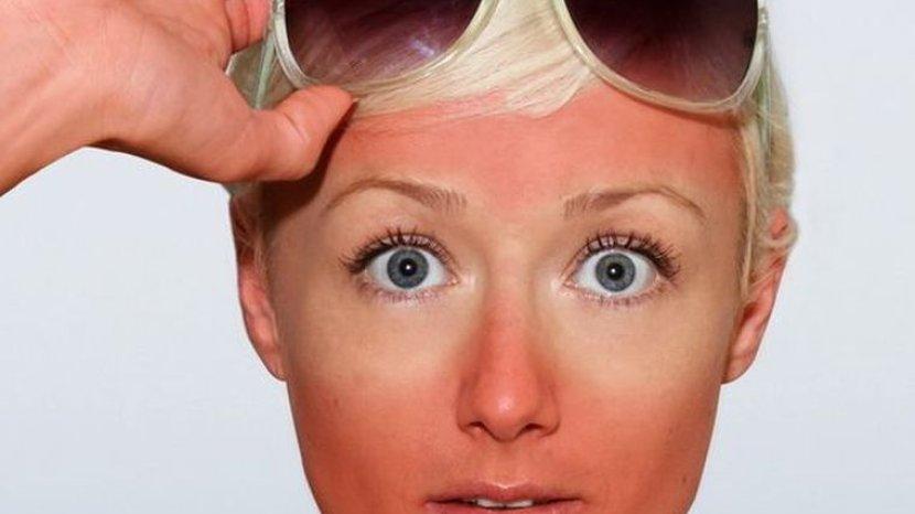 7 Bahan Alami Ampuh Mencerahkan Kulit Belang tanpa Biaya Mahal