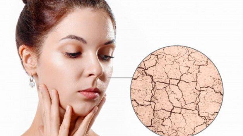 Ini 6 Tips yang Harus Kamu Perhatikan sebelum Memilih Serum untuk Kulit Kering