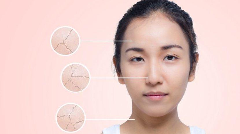 5 Rekomendasi Toner Terbaik yang Cocok untuk Kulit Kering