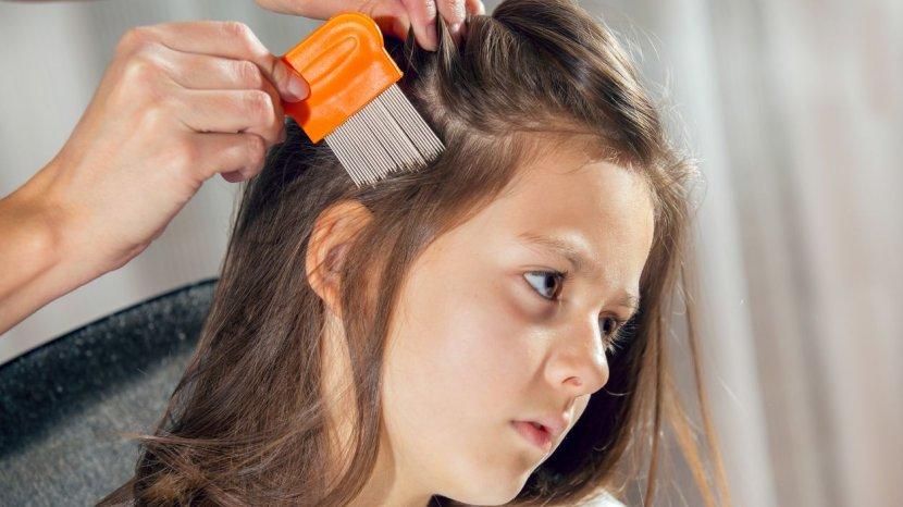 Bye-bye Gatal di Kepala, Ini 5 Cara Hilangkan Kutu Rambut dengan Mudah