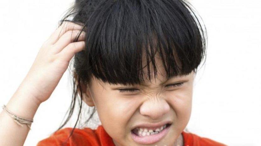 Penyebab Anak Kecil Sering Kutuan dan Cara Ampuh Mengatasinya, Bisa Pakai Bahan Alami