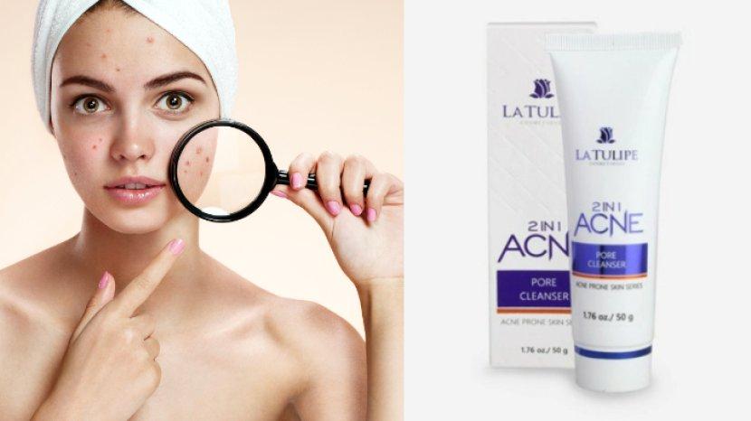 Review LA TULIPE Acne 2 In 1 Pore Cleanser, Sabun Muka untuk Tipe Kulit Wajah yang Rentan Berjerawat