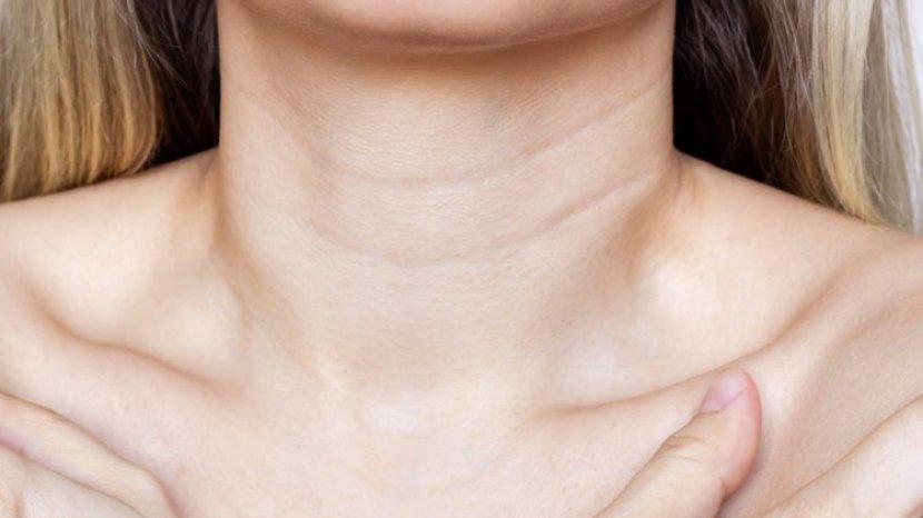 Tak Perlu Risau, Ini 7 Cara Mudah Mengatasi Masalah Leher Bergaris yang Mengganggu Penampilanmu