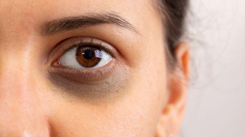 5 Rekomendasi Eye Cream Kualitas Terbaik, Ampuh Atasi Mata Panda
