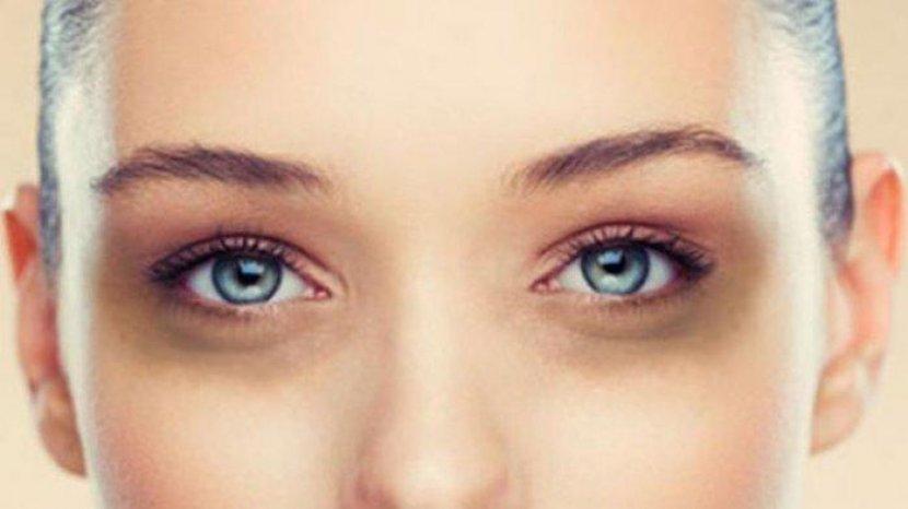 Kurang Tidur di Bulan Ramadhan Menyebabkan Mata Panda? Hempas dengan Rekomendasi Eye Cream Ini