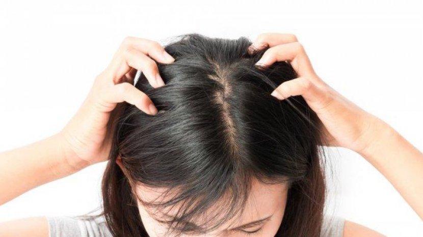 Jarang Diketahui, 4 Bahan Alami Ini Bisa Digunakan Untuk Menghilangkan Kutu Rambut
