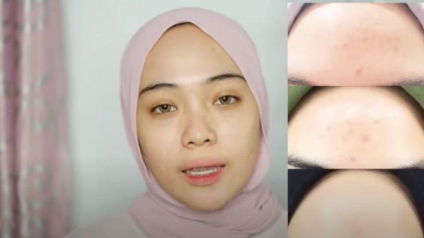 Morning Skin Care Untuk Wajah Bruntusan Ala Putri Melati