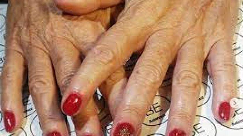 Jangan Pernah Gunakan Kuteks Ketika Kuku Mengalami 4 Hal Ini