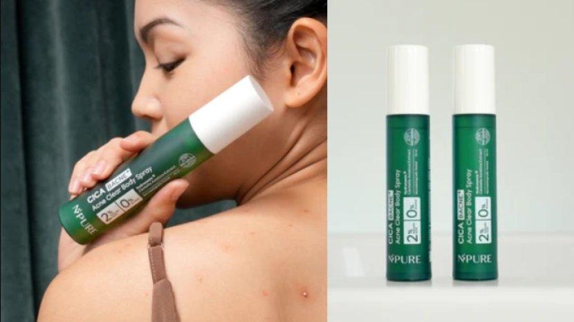 Review NPURE Cica Acne Clear Body Spray, Ampuh Hempas Masalah Jerawat di Punggung