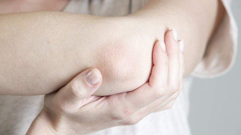 5 Langkah Sederhana Merawat Siku Tangan Agar Tidak Kering