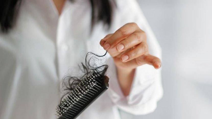 5 Cara Ampuh Mengatasi Rambut Rontok Penyebab Kebotakan pada Remaja, Cuma Pakai Bahan Alami