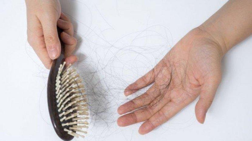Tak Melulu Karena Sampo, Ini 6 Hal Penyebab Rambut Rontok Berlebih