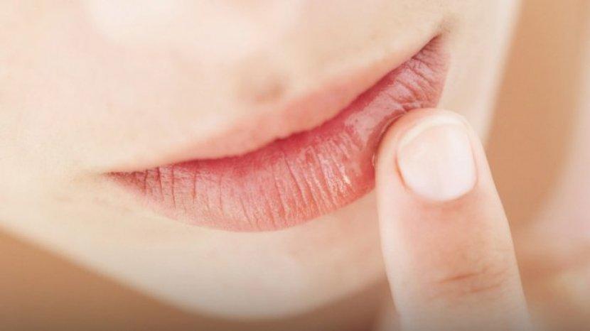 Bibir Kering dan Pecah-pecah akibat Lipstik? Atasi dengan 8 Bahan Alami Ini