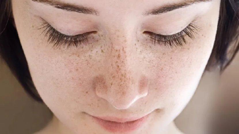 7 Bahan Alami untuk Memudarkan Flek Hitam di Wajah, Tanpa Perlu Treatment di Klinik Kecantikan