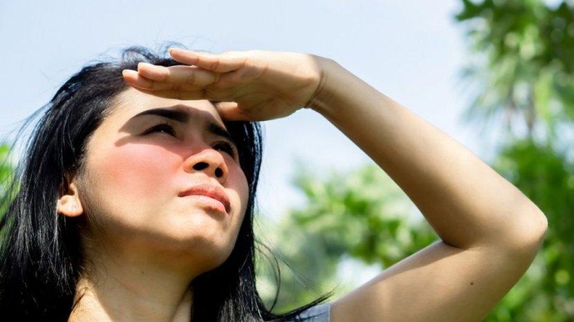 7 Pertolongan Pertama pada Kulit Sunburn atau Terbakar Matahari